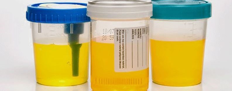 Synthetic Urine 
      For Passing Drug Test Howland Acres Vancouver WA
